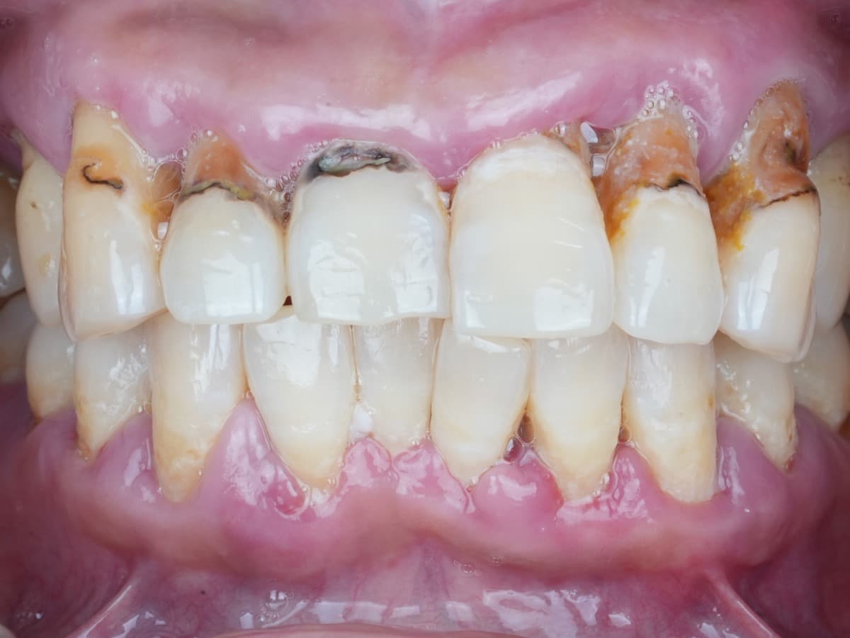 Before treatment