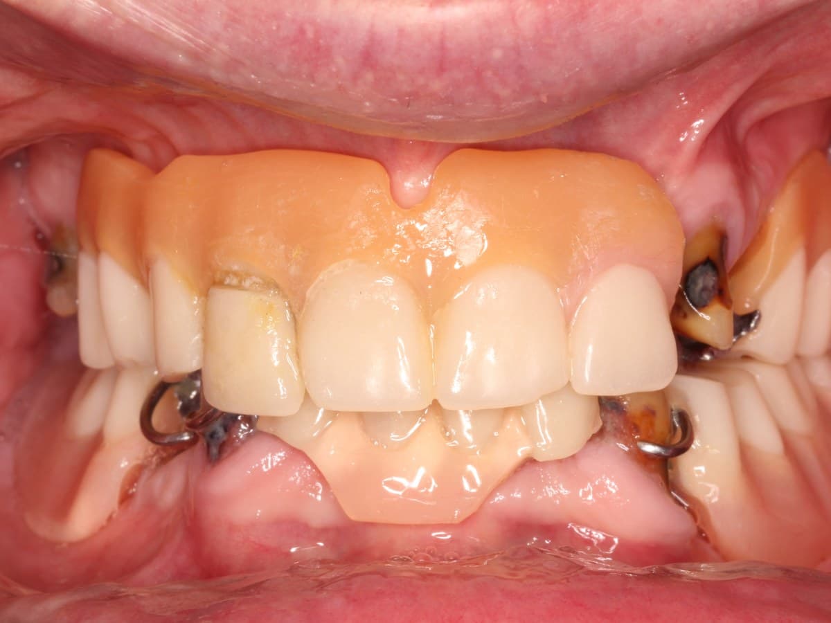 Before treatment