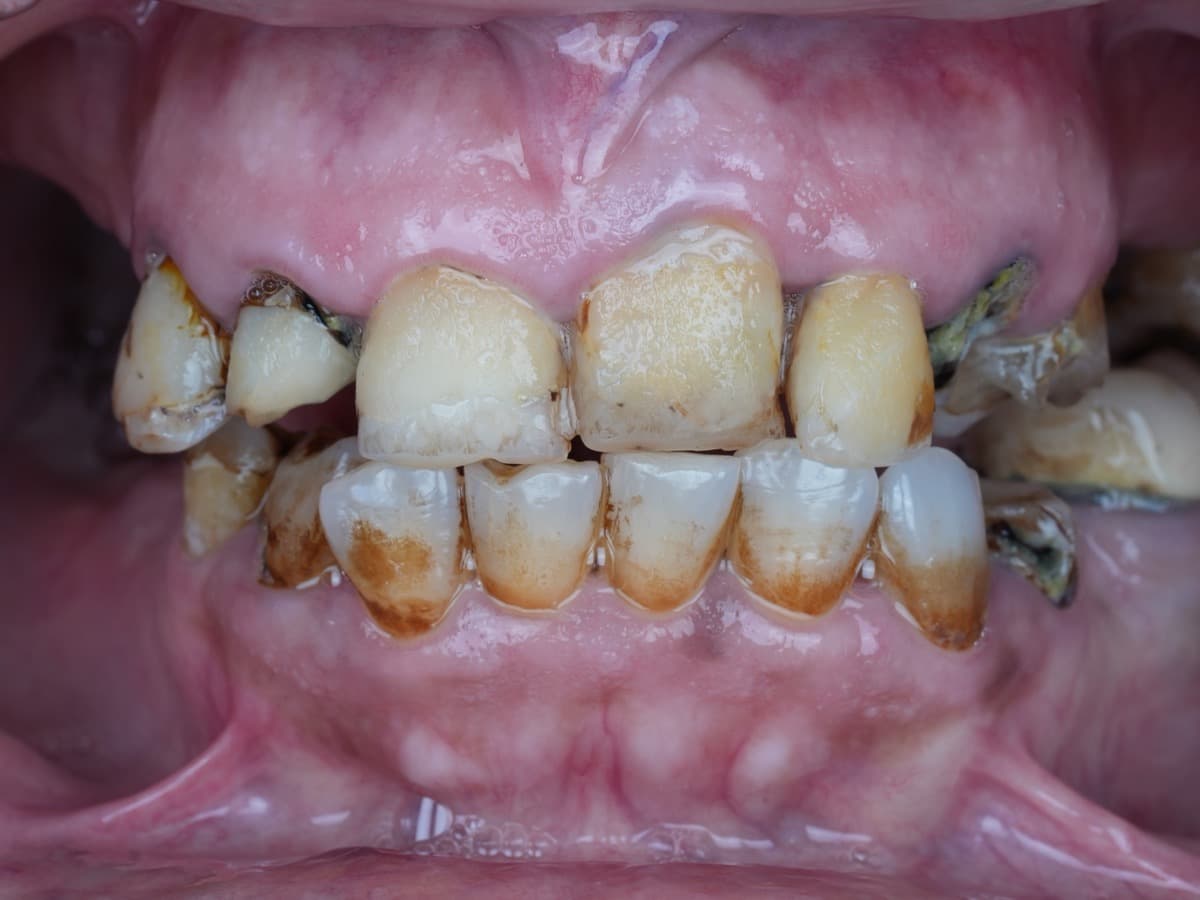 Before treatment