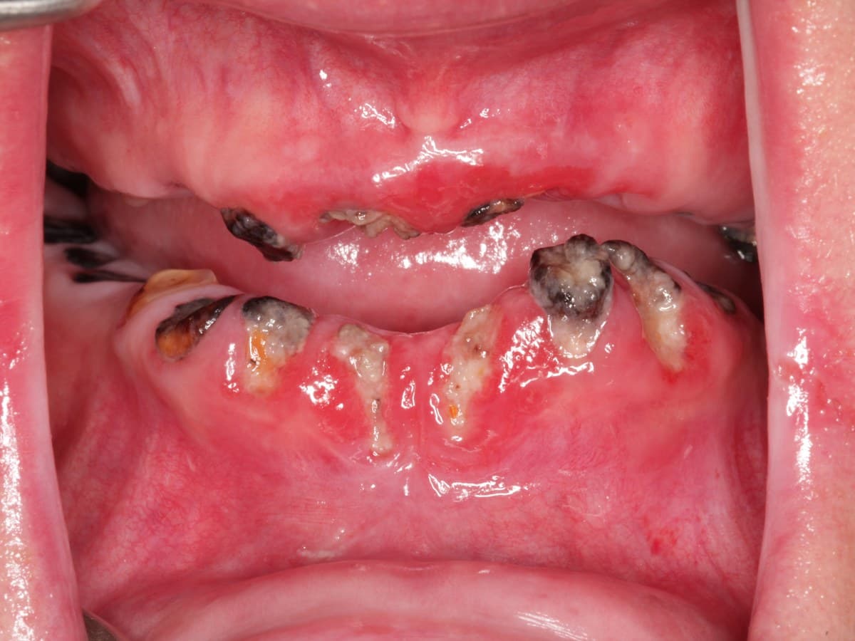 Before treatment
