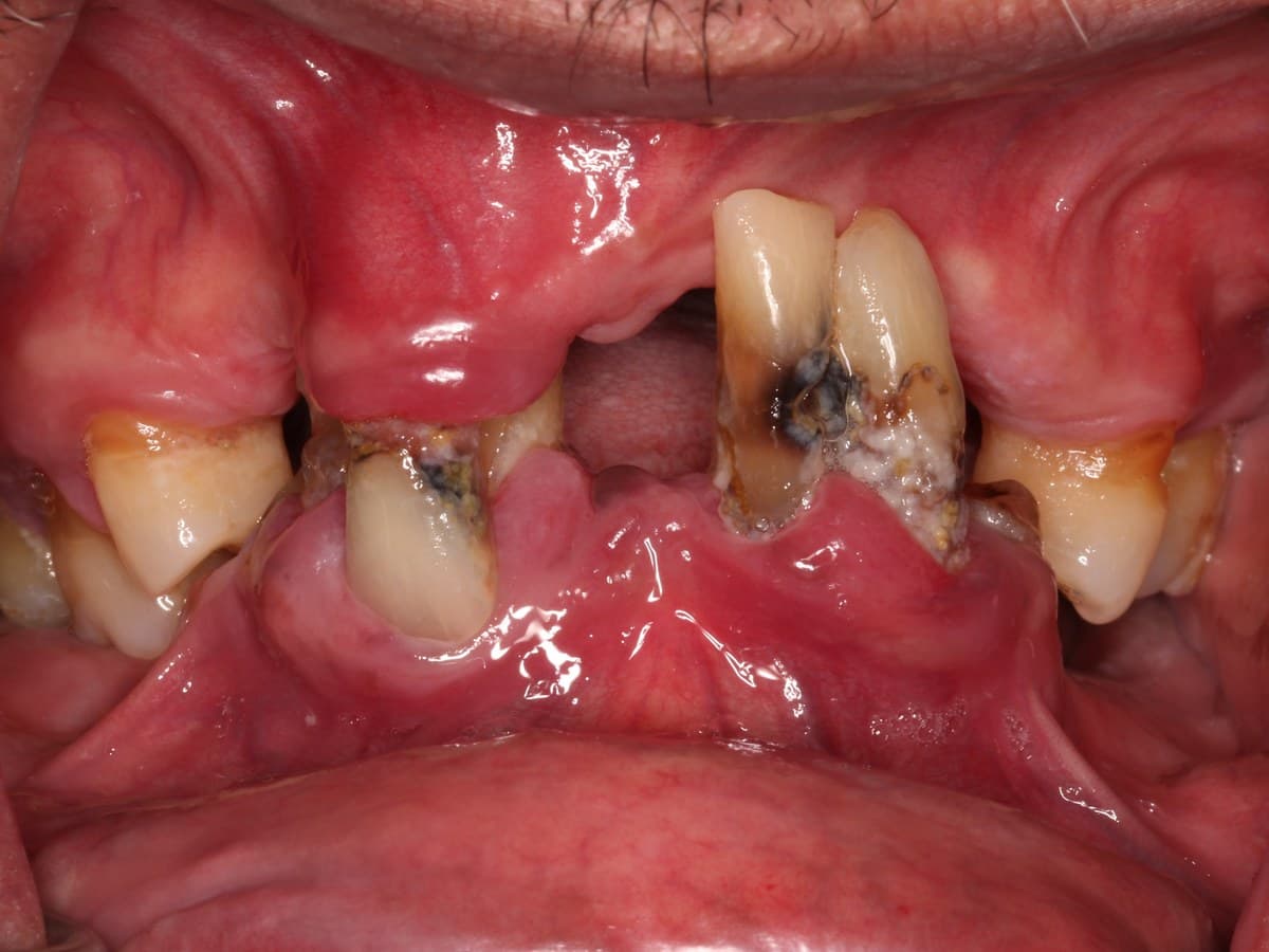 Before treatment
